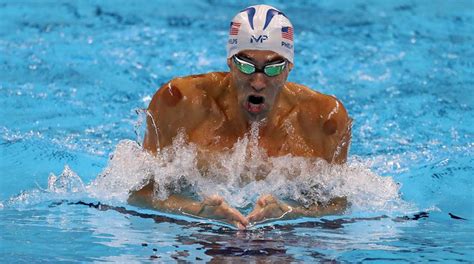 Why Michael Phelps Other Olympic Athletes Use Cupping Therapy For