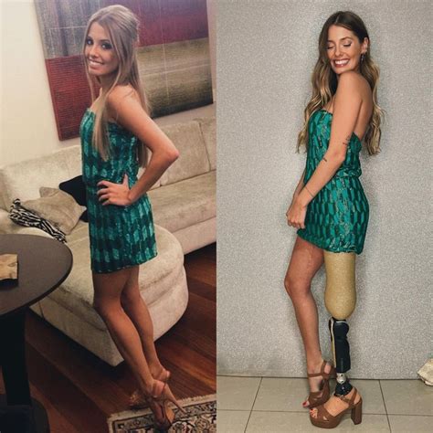 Meet Paola Antonini An Amputee Model Who Treats Her Prosthetic Leg As
