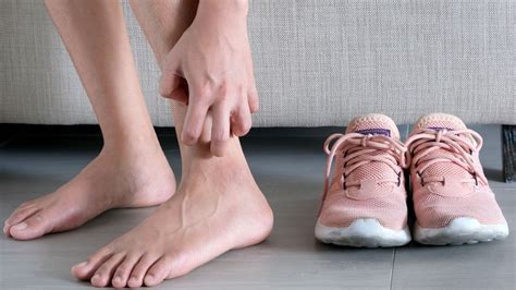 What It Means When You Have An Itchy Ankle