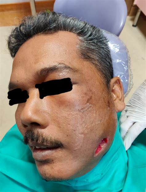 Tapi apa tak ingin mencegahnya daripada merasakan sakit dan ngilu di gigi? Obati Sakit Gigi Pakai Minyak Rem, Pria Ini Alami Infeksi ...