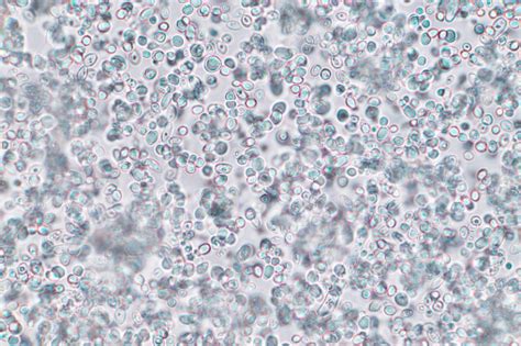 Yeast consists of single cells. Budding Yeast Cell Under The Microscope Stock Photo ...