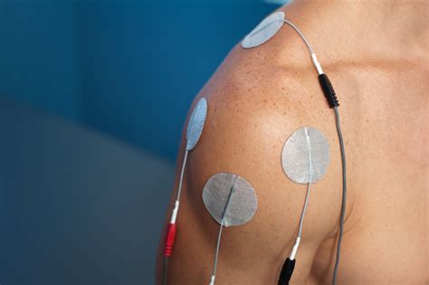 How Electrical Stimulation Therapy Enhances Healing Pain Arthritis