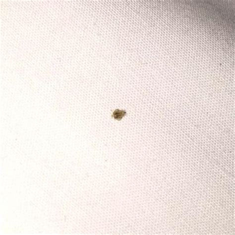 body lice in bed - Picture of Waldorf Bankside Serviced ...