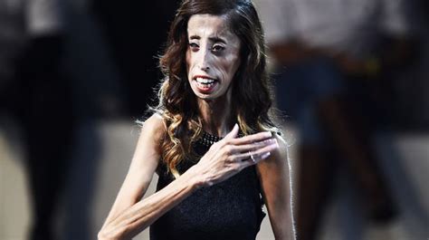 Woman Cruelly Dubbed World S Ugliest Reveals Amazing Way She Copes With Online Trolls World