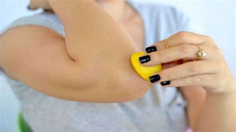 Se débarrasser des frelons naturellement. Voici comment se débarrasser des coudes noirs ...