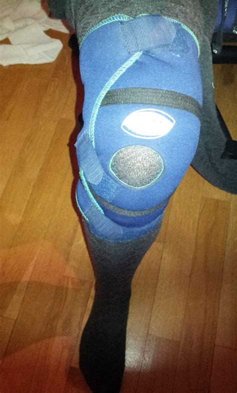 Frage über Bandage Tsm Arzt Schmerzen Knie