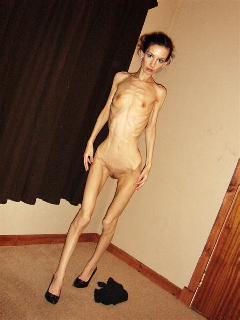 Anorexic Porn Image