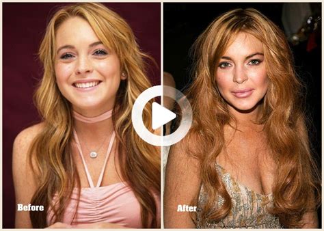 Top 10 Worst Celebrity Plastic Surgery Hollywood D