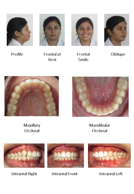 Dentosphere World Of Dentistry Photographs In Orthodontics Dental