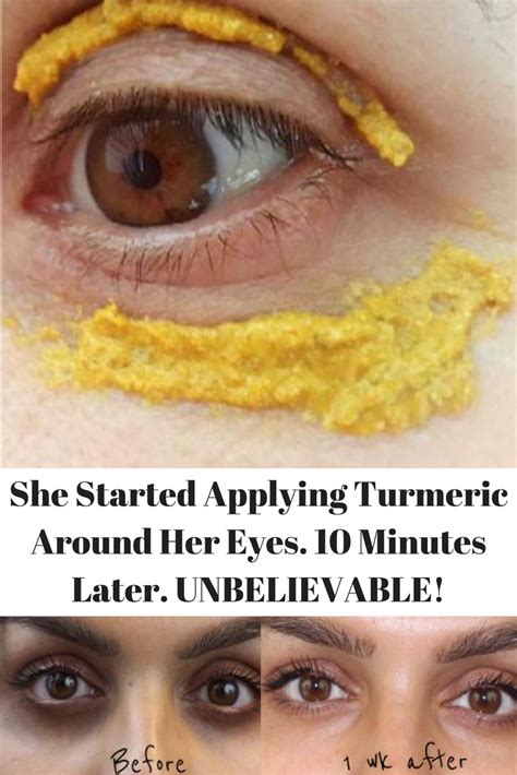 She Started Applying Turmeric Around Her Eyes 10 Minutes Later
