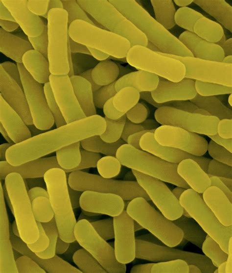 Lactobacillus Sp Gram Positive Photograph By Dennis Kunkel Microscopy