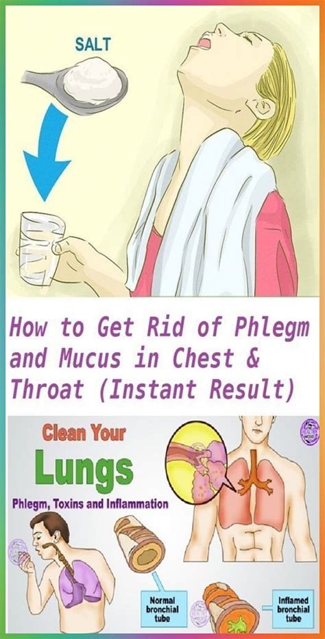 Break Up Phlegm And Mucus Relationship