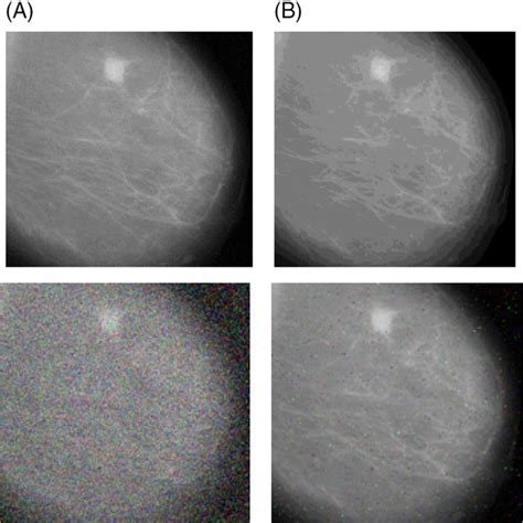 Sample Mammography Images From A Mias Database And B Ddsm