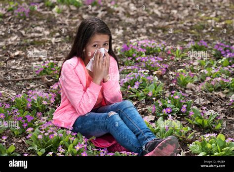 Allergic Reaction Eyes High Resolution Stock Photography And Images Alamy