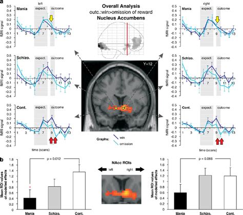 Differential Functional Magnetic Resonance Imaging Fmri Activation