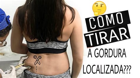 Aplicação de enzimas para redução de gorduras e medidas Lipo sem CIRURGIA YouTube