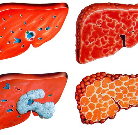 Zentrales symptom einer alkoholsucht ist ein kaum beherrschbares verlangen nach alkohol. Nahrungsergänzung: Zu viel des Guten ist schlecht für die ...