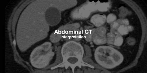 Abdominal Ct Phases • Litfl • Radiology Library