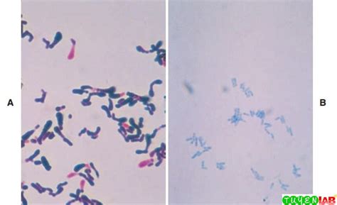 Microbiology Atlas Of Aerobic Gram Positive Bacilli