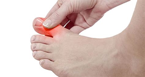 Toe Pain Symptoms Causes And Treatment