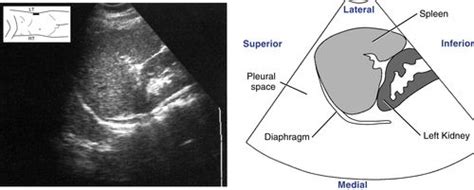 Spleen Scanning Protocol Radiology Key