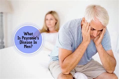 Peyronie S Disease A Natural Treatment For Absolute Men Health