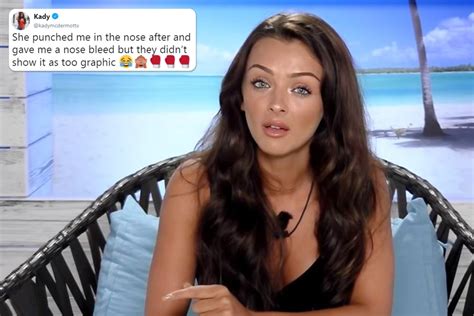 Kady Mcdermott Reveals She Was Punched In The Face And Left With Bleeding Nose In Unaired Love