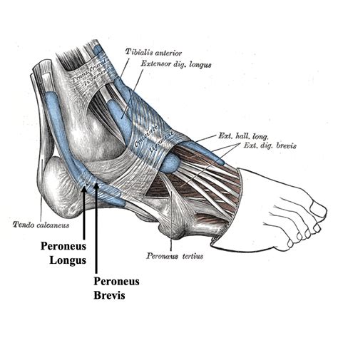 Peroneal Tears — Daniel Bohl Md Midwest Orthopaedics At Rush