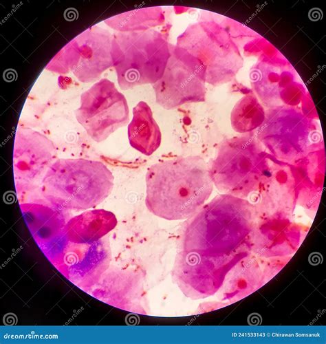 Bacteria Cell Gram Neagative Bacilli With Capsulesample Sputum In Gram