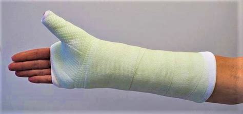 Can A Broken Hand Heal Without A Cast Donald Larmon Blog