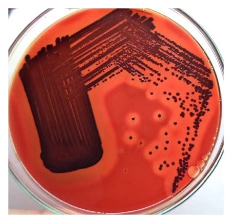 β Hemolytic Colonies On Blood Agar Download Scientific Diagram