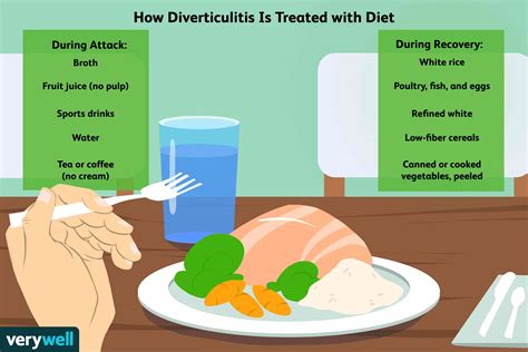 Diverticulitis Surgery Prep And Recovery