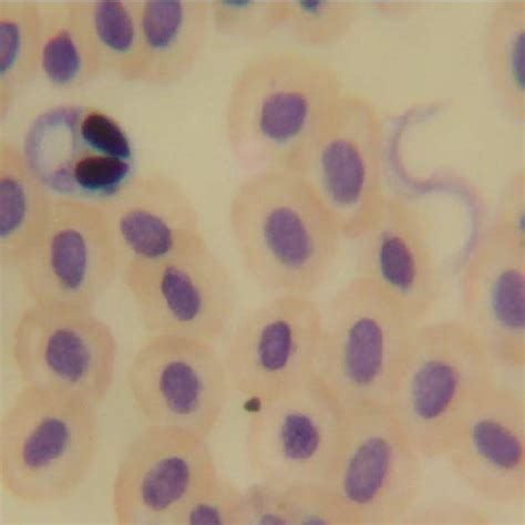 Both Trypanosoma And Myxospora Occurring Together In Blood Smear Of