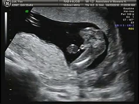 Baby Boy Pregnancy Ultrasound Pregnancywalls