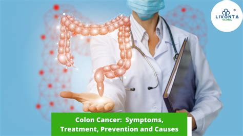 Colon Cancer Symptoms Treatment Prevention And Causes Livonta