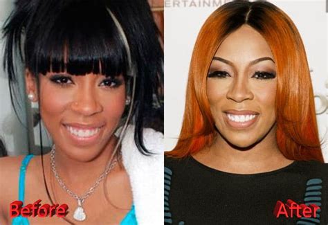 Black Celebrities Plastic Surgery Before And After
