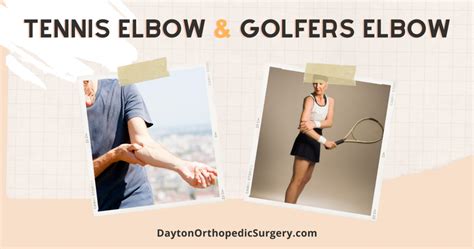 Tennis Elbow Golfers Elbow Dayton Orthopaedic Surgery