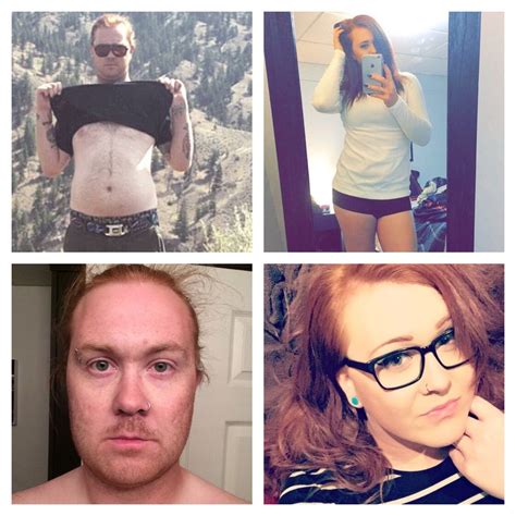 List Pictures Male To Female Transition Surgery Pictures Stunning