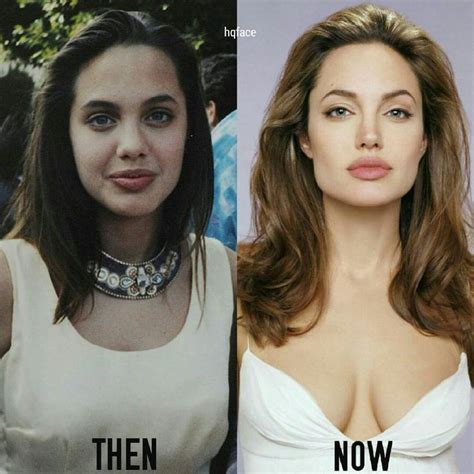 Angelina Jolie Before Plastic Surgery