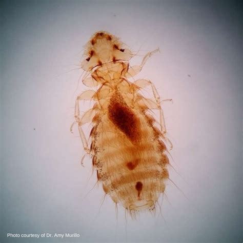 Chicken Lice Expert Tips For Identification And Management 2023