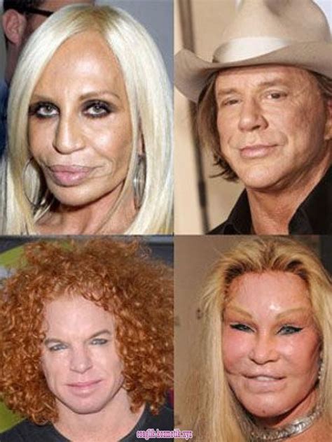 Over 50 Over 50 Bad Celebrity Plastic Surgery Celebrity Plastic