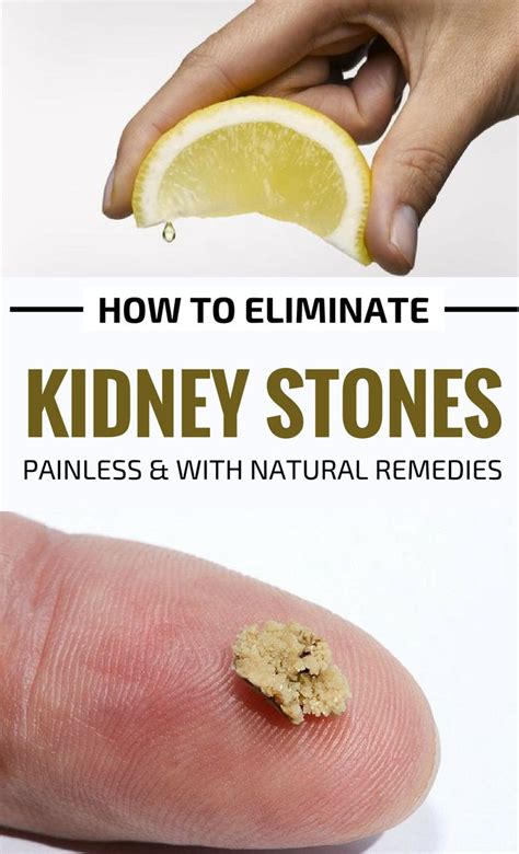 Eliminate Kidney Stones Painlessly With This Amazing Homemade Remedy In
