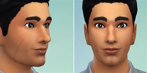 Collection Of Sims 4 Cc Scars Pin On Sims4 Cc Pin On