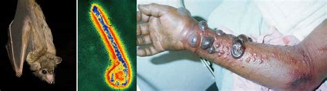 The incubation period is 2 to 21 days and the onset of symptoms is sudden fever, chills, trembling, headaches, myalgia, nausea, vomiting. Marburg virus transmission, disease, symptoms, diagnosis ...