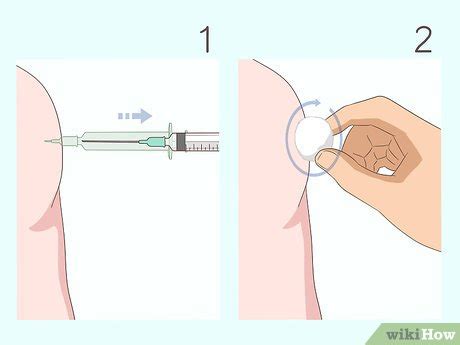 To give a b12 injection, start by cleaning the injection site, such as the upper arm or thigh, with a cotton ball dipped in rubbing alcohol to sterilize the area. How to Give a B12 Injection: 15 Steps (with Pictures ...