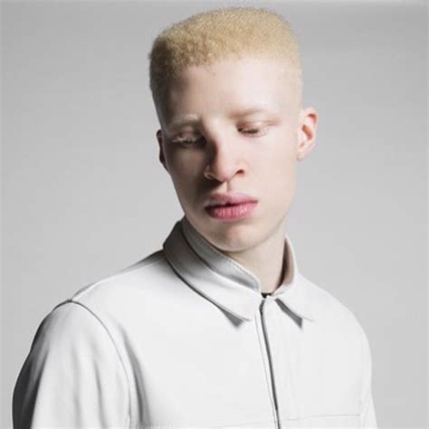 Top 100 Imagen Negro Albino Modelo Abzlocalmx