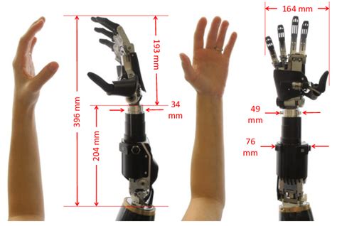 Ric Prosthetic Arm Compared With The 25 Th Percentile Female Arm