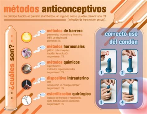 Cuadro Comparativo De Metodos Anticonceptivos Farmaco Vrogue Co