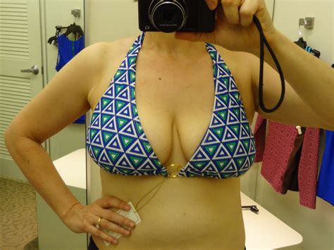38d breast reduction