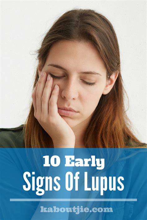 10 Early Signs Of Lupus Lupus Facts Autoimmune Disease Lupus Signs